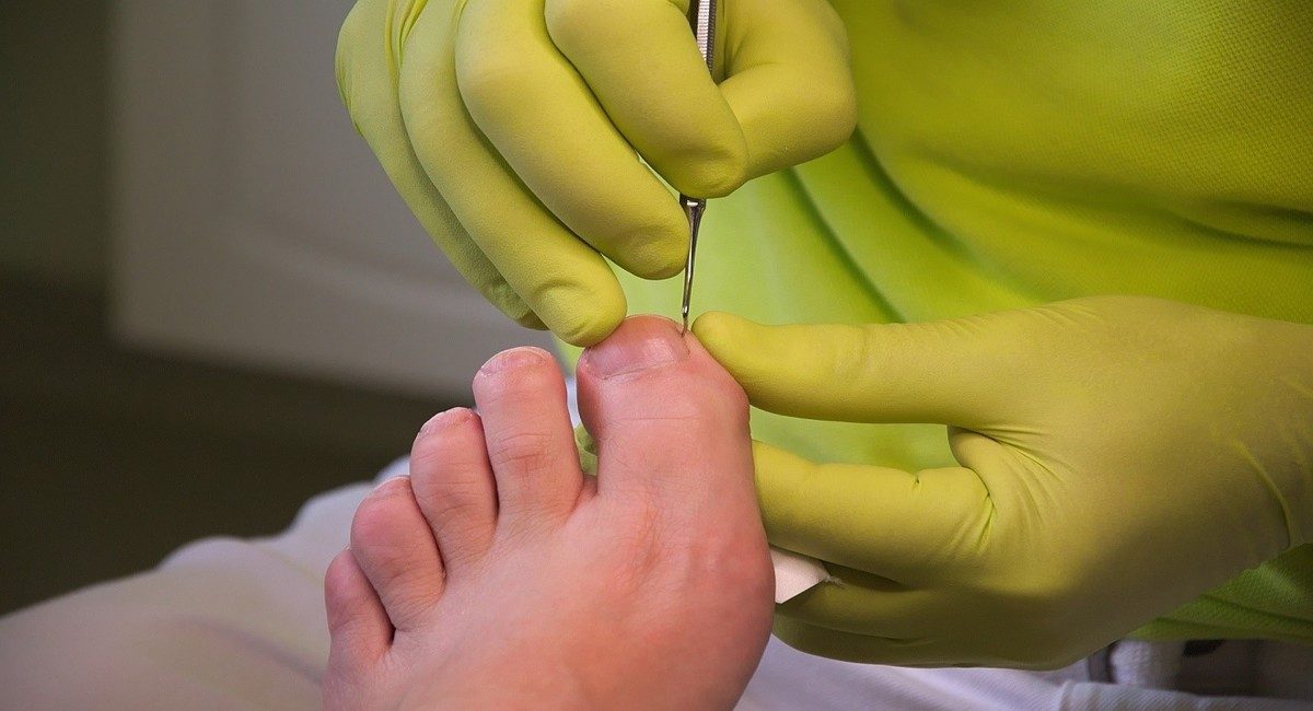 Nursing Foot Care
